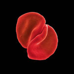Musta pohjaväri ja sen keskellä kaksi solua, jotka lienevät verisoluja. Solut tavallaan kietoutuvat toisiinsa ja ne ovat litteämpiä kuin halkaisijaltaan leveitä.